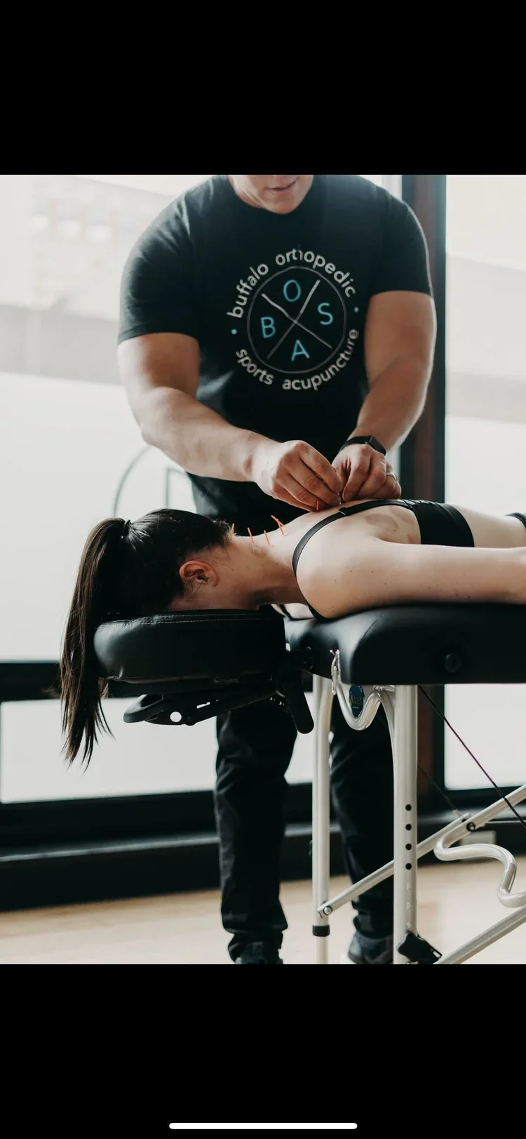 upper body acupuncture