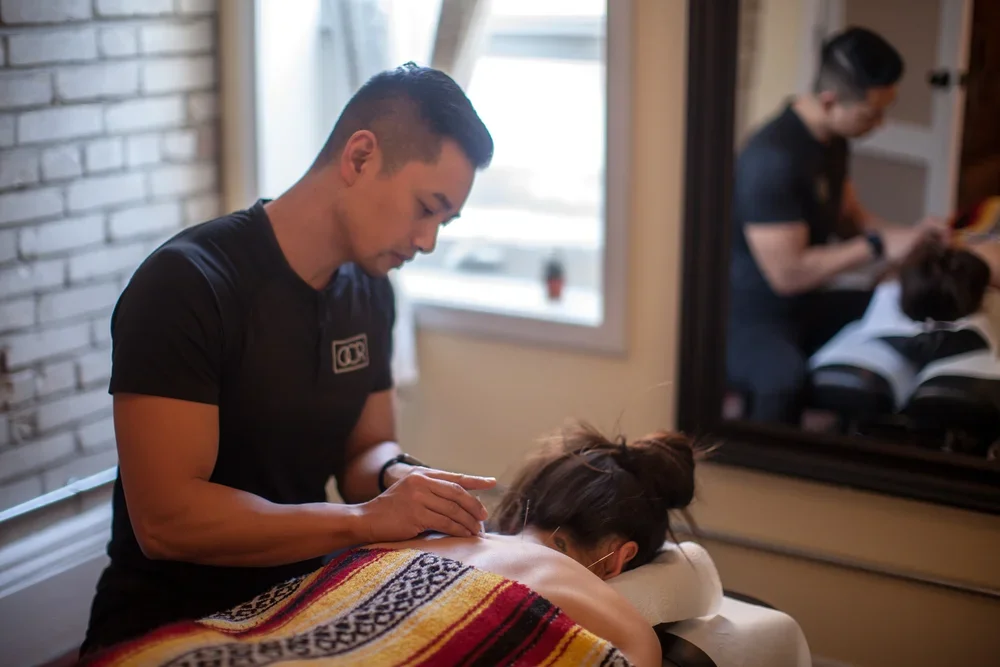 acupuncture to upper back