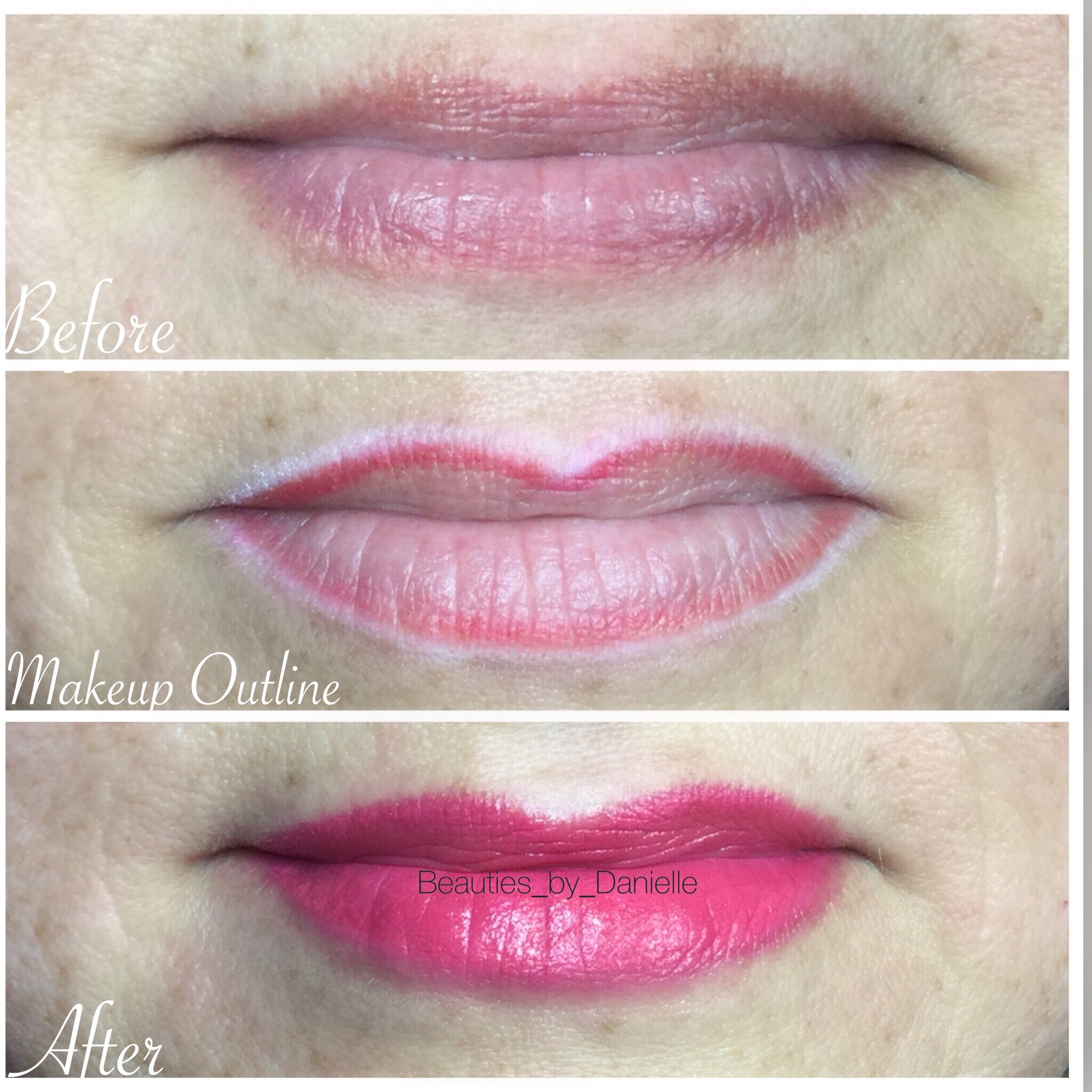 Recovery Cosmetic Lip Tattoo Healing Process