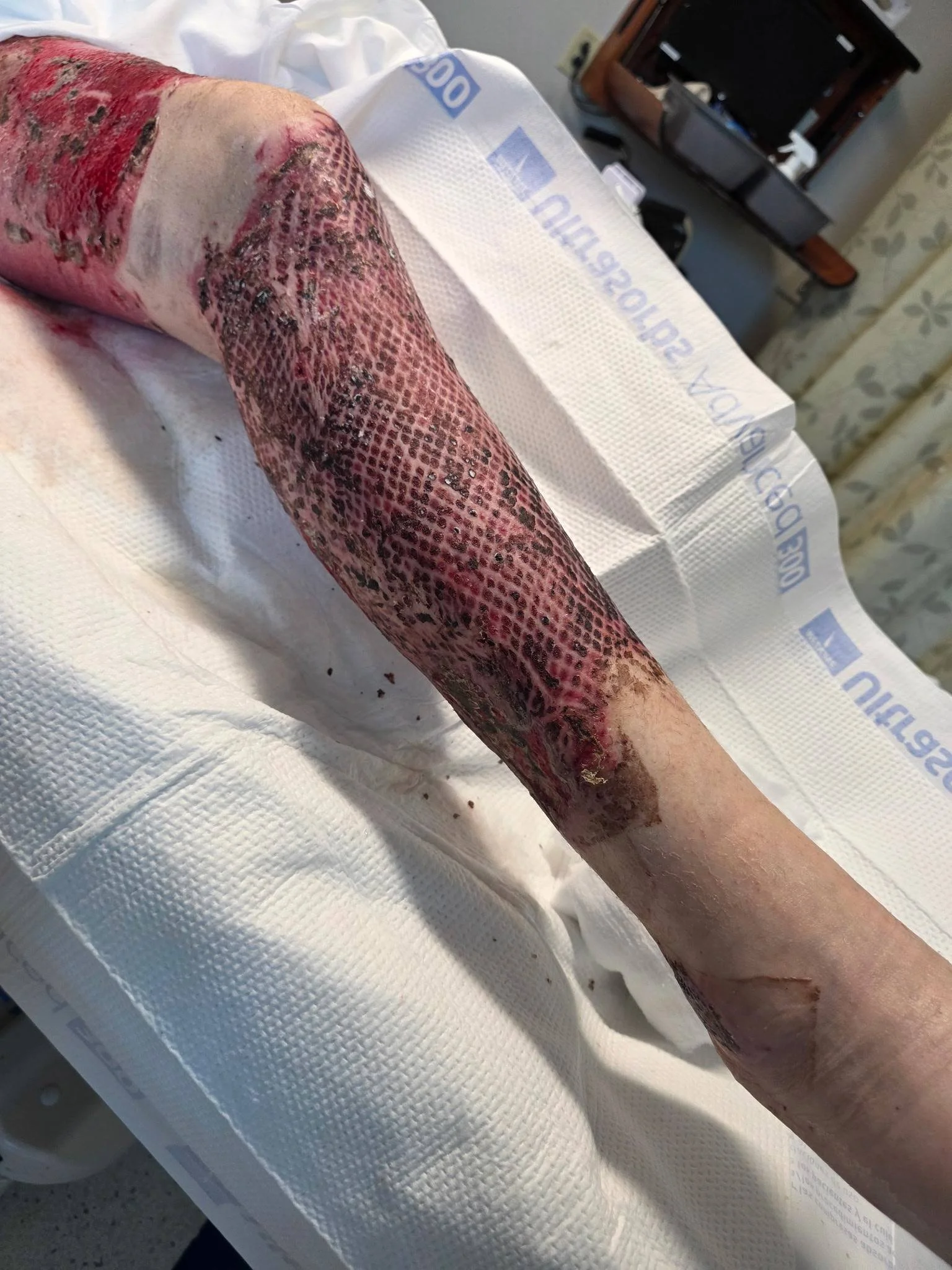 I got out of the hospital on Thursday 🙌

This has definitely been the hardest challenge I've ever had to endure but the support from everyone hasn't gone unnoticed. Whether it was a text message, fb message, donation, participation in bowling tourna