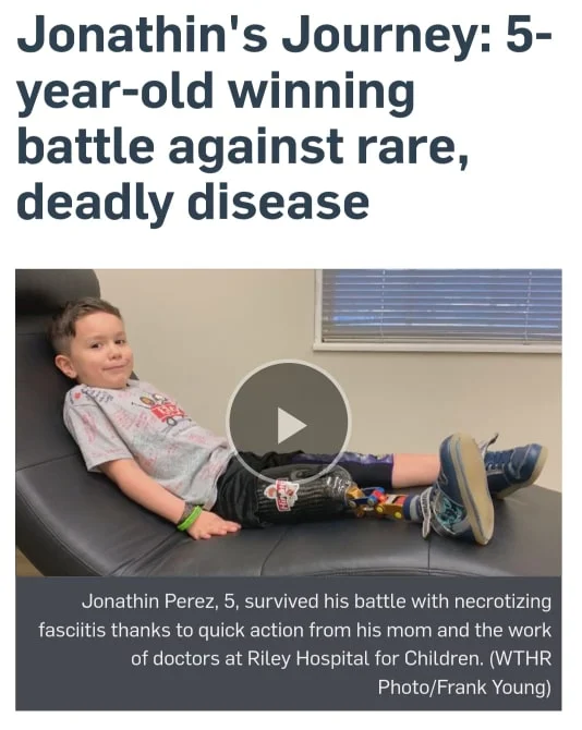 Jonathin Perez was just four years old when Necrotizing Fasciitis took his leg, and nearly his life. But he’s not letting that slow him down. https://www.wthr.com/article/jonathins-journey-5-year-old-winning-battle-against-rare-deadly-disease