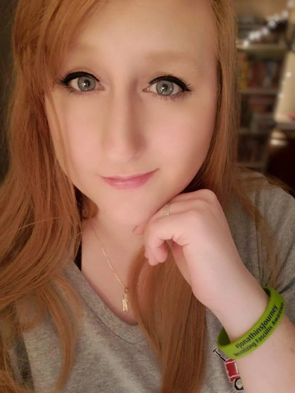 Katie Wilson-Perez Chief Financial Officer Director of Social Media Hospitality Industry since 2006 Indianapolis, IN Son is an NF Survivor since 2018 Katie@necfasc.org