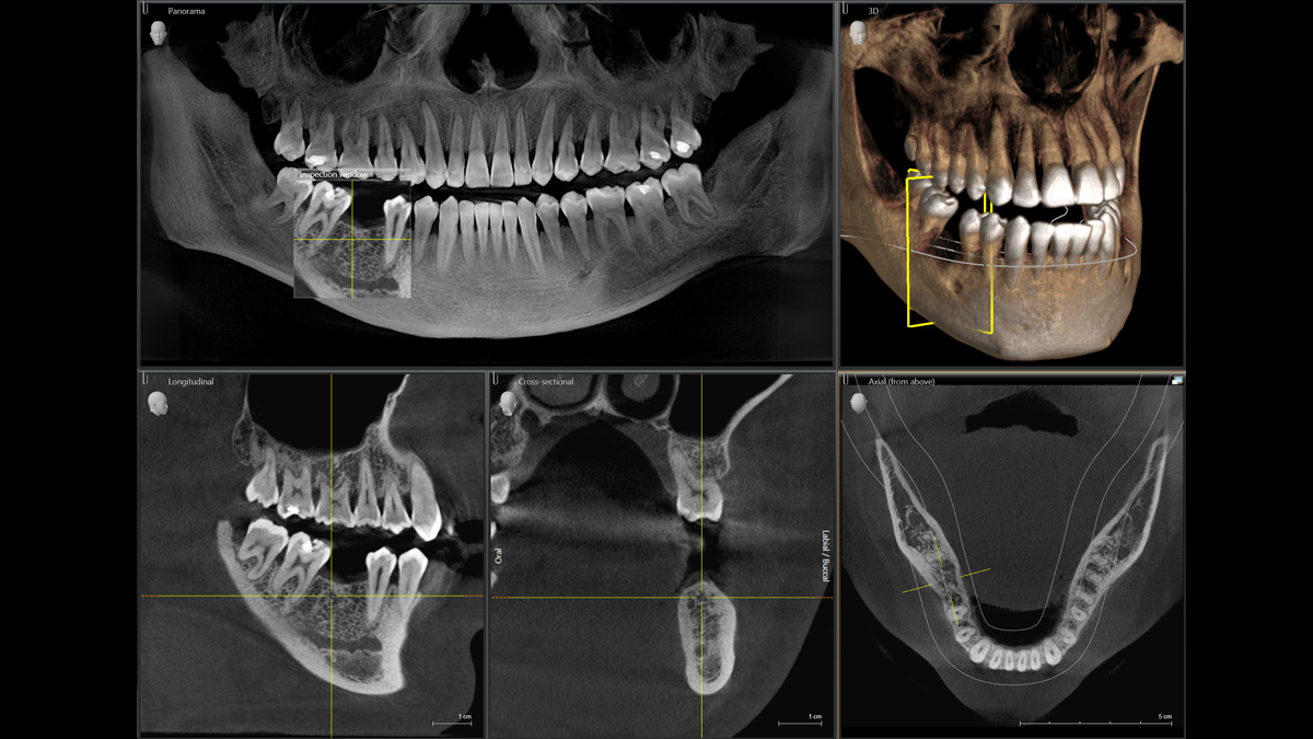 CBCT.png