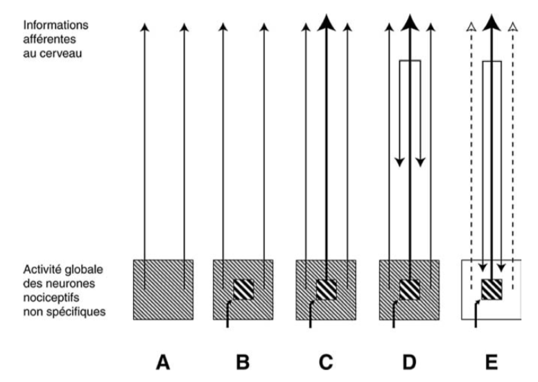Interprétation hypothétique de l’activité globale des neurones spinaux et trigéminaux liés à la nociception. D’après Calvino B et Grilo RM. Le contrôle central de la douleur. Revue du rhumatisme 73 (2006) 10-18