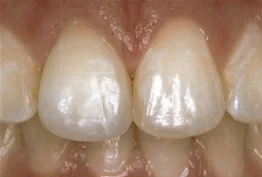 teeth3.jpg