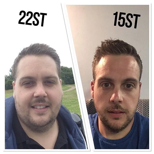 i want to lose weight in my face