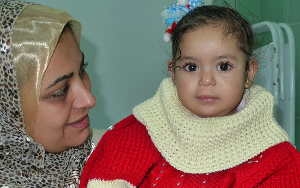 Baby cleft lip repair 1 year after surgery with happy Mom