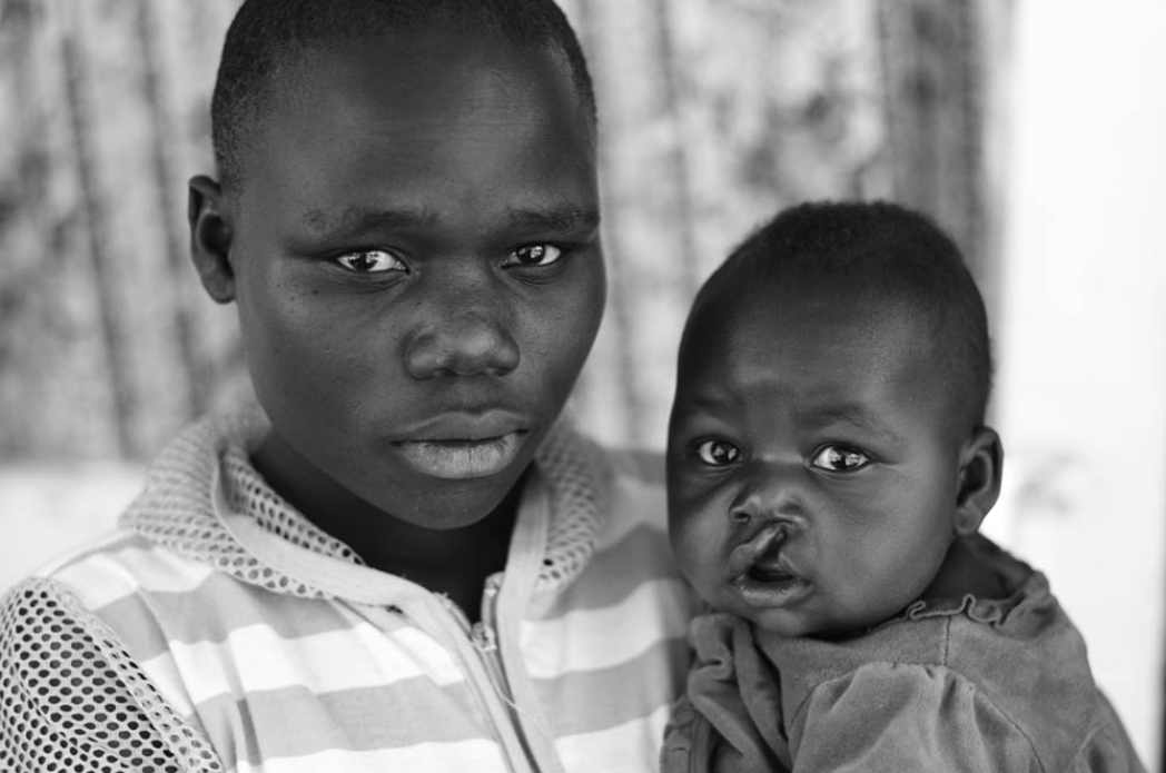 Mom and baby were transported 3 hours to us for cleft lip repair
