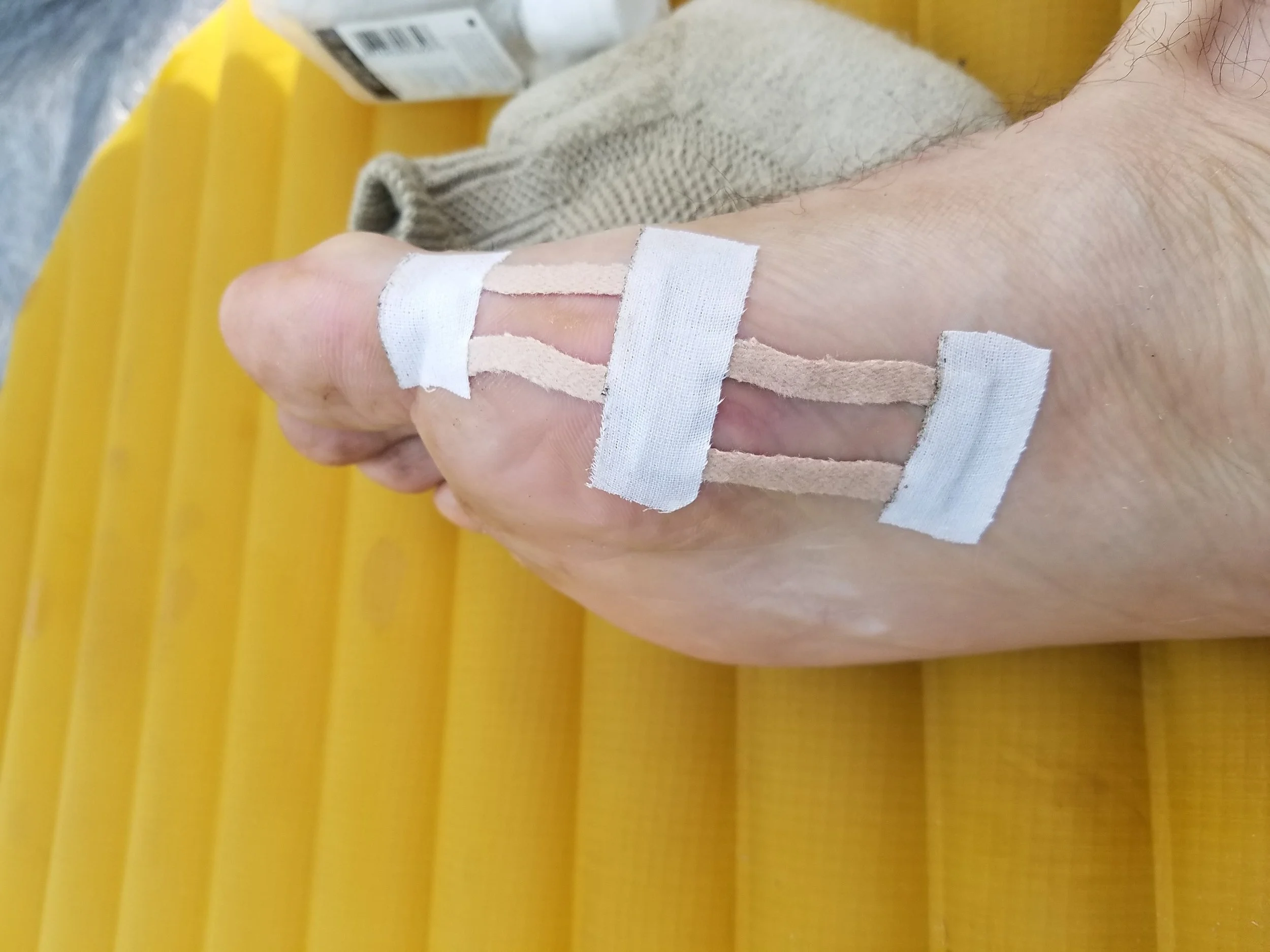 Bandaging up all the blisters for the next day.