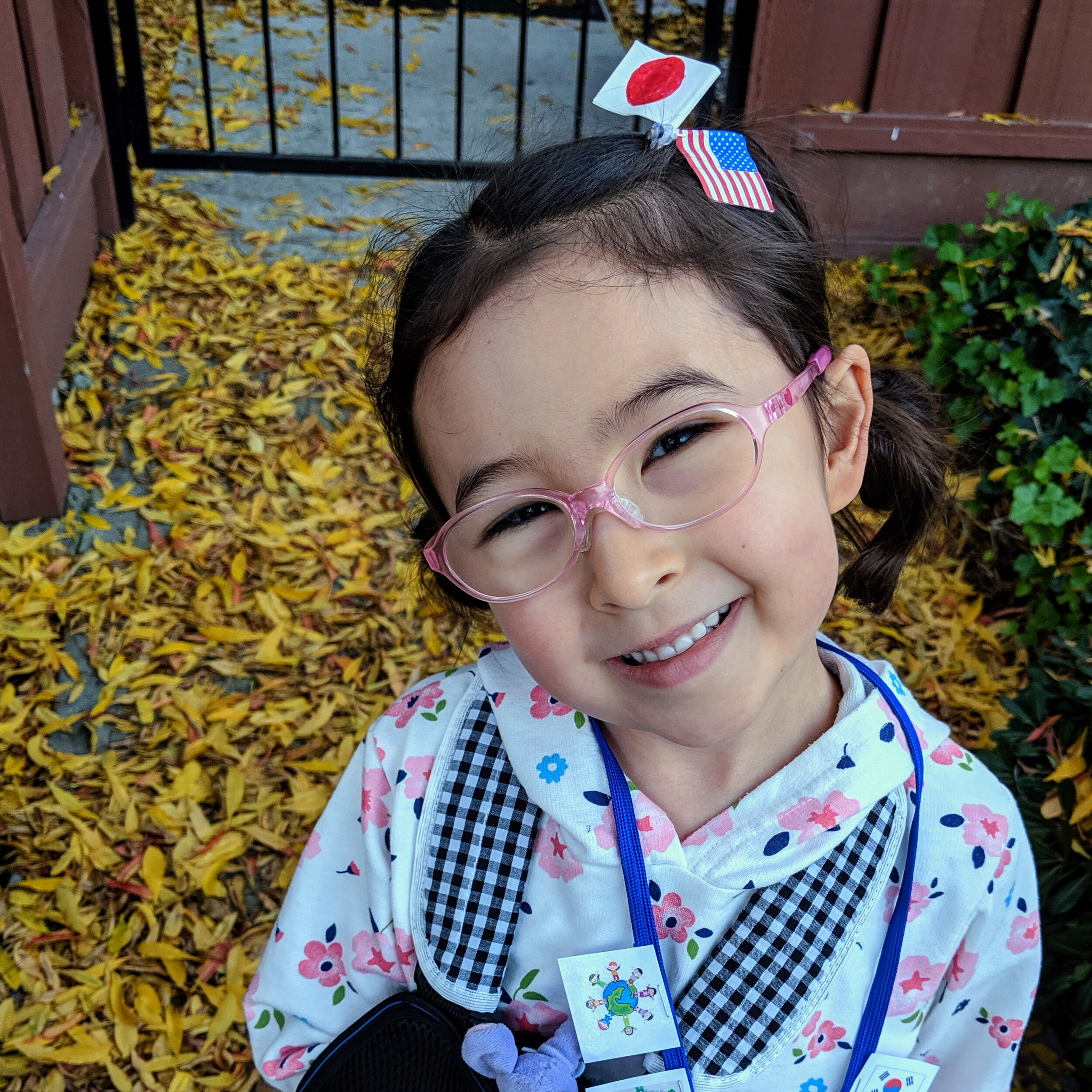 Children's hospital creates custom glasses system for child with ear  deformity - ABC News