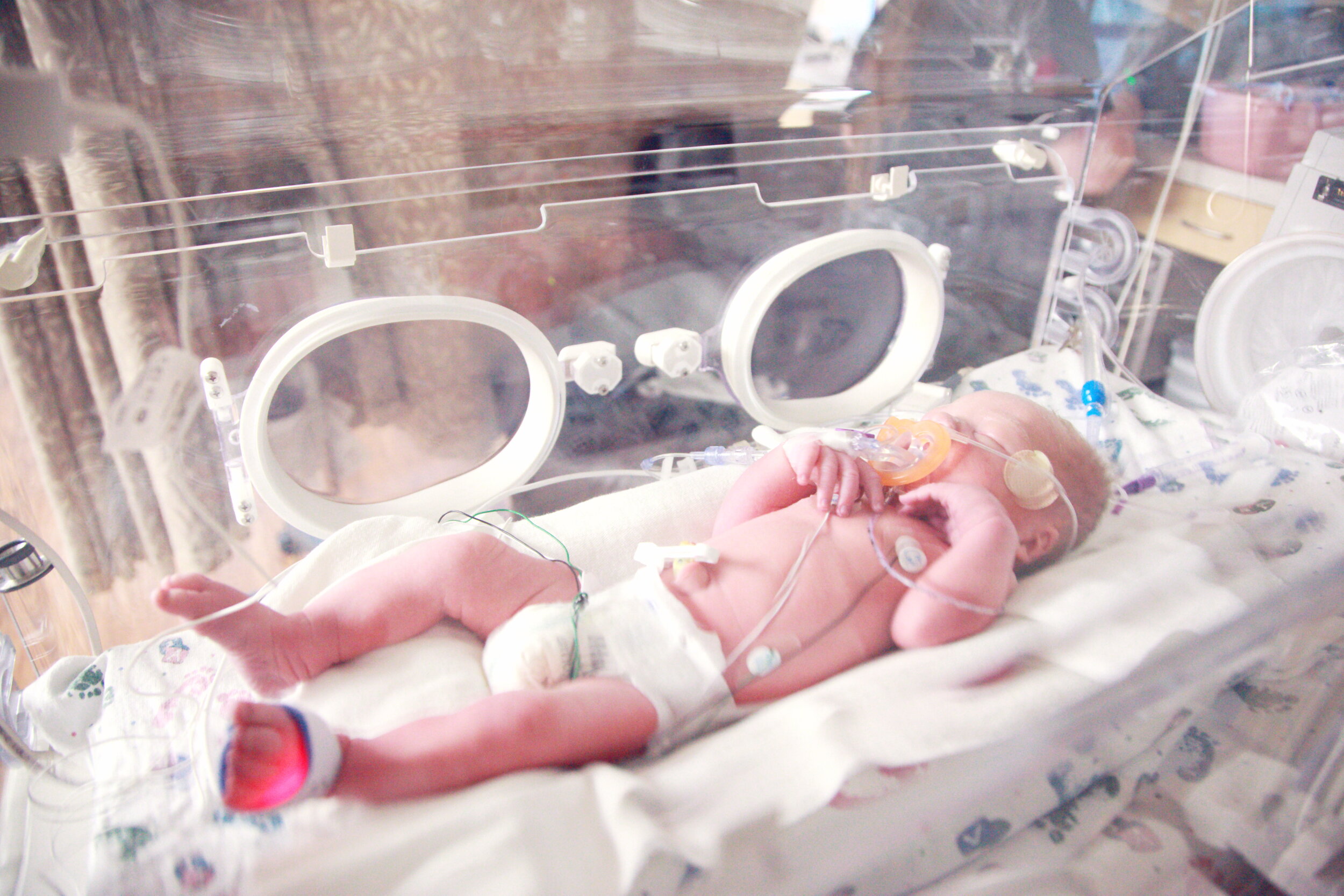 Premature babies may have to spend time in an incubator.