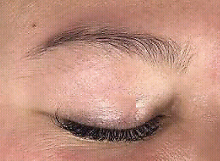 Microblading Before 1.png