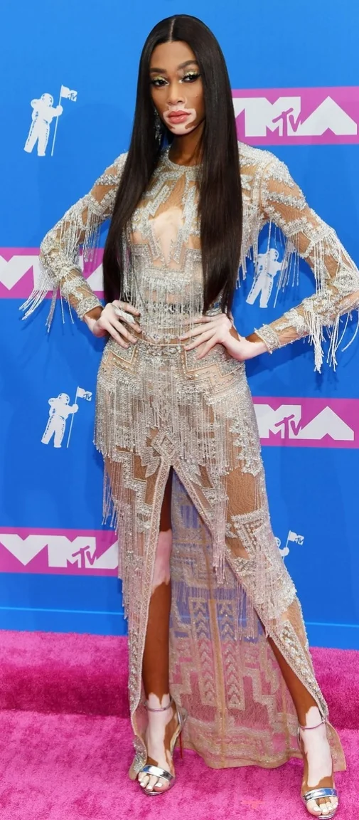 winnie-harlow-2018-vma-red-carpet-01.jpg