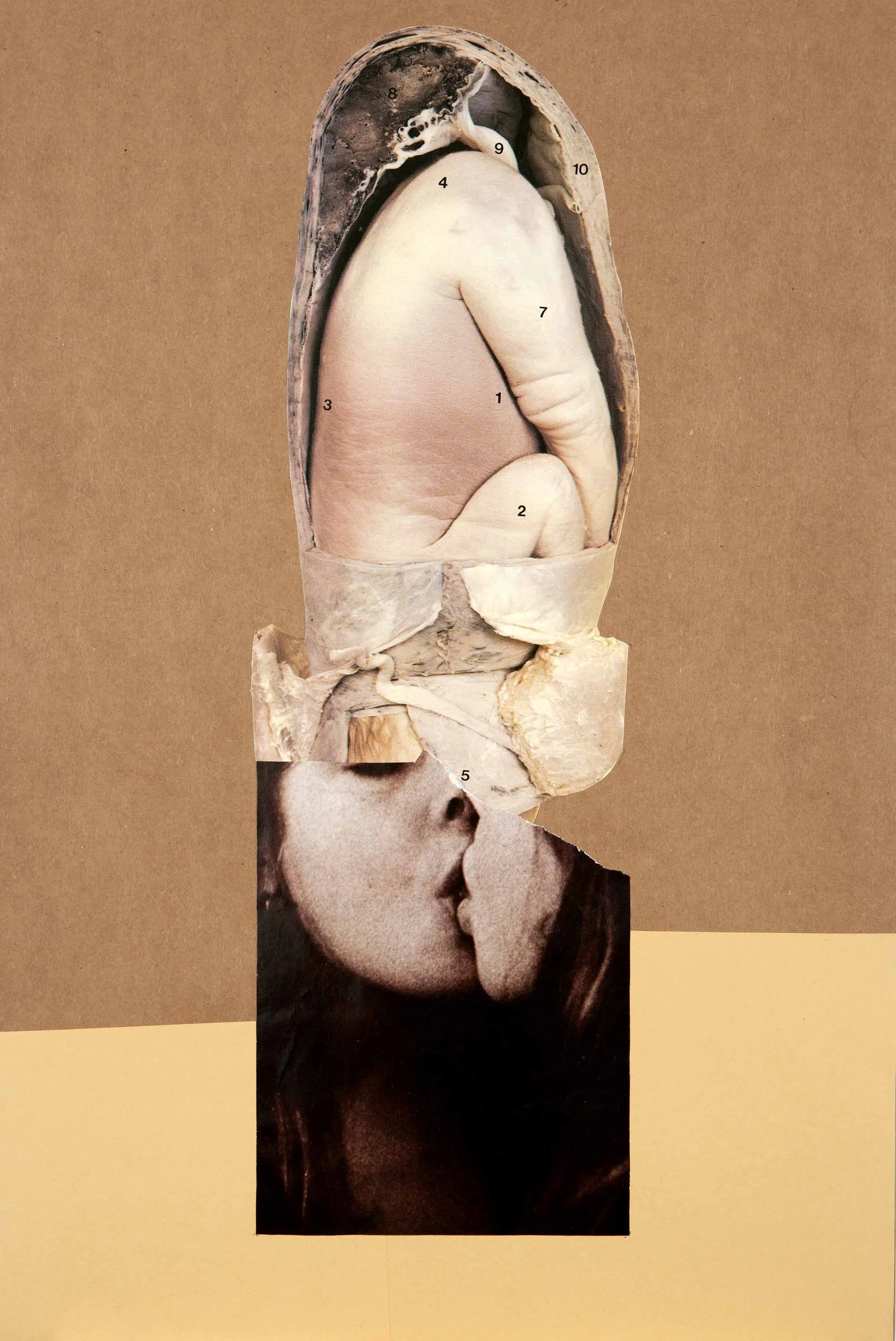 Narcissus Foetus , 2012. Collage, 42,5 x 28,6 cm.