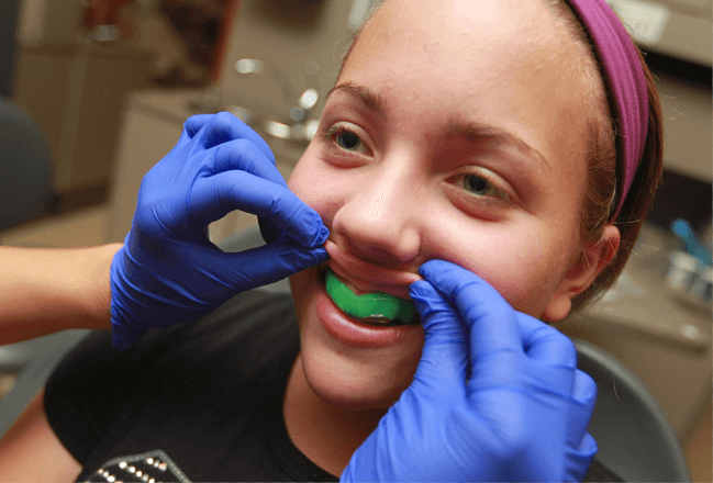 mouthguards.png