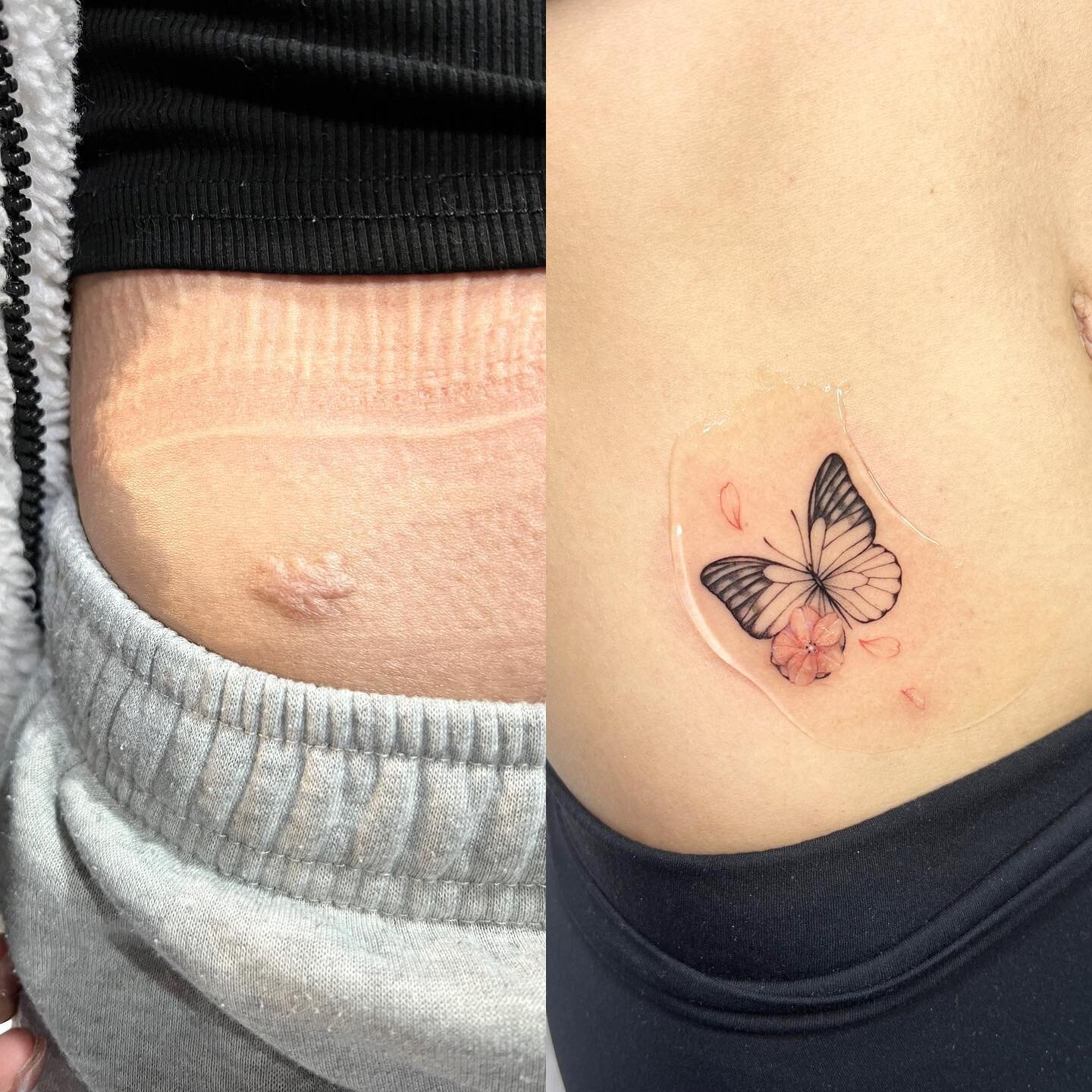 Surgery scar cover up done by @jingstattoo 
#scarcoverup #rosetattoo #flowertattoo #butterfly #hiptattoo #nyctattoo #nyctattooartist #smalltattoo #finelinetattoo