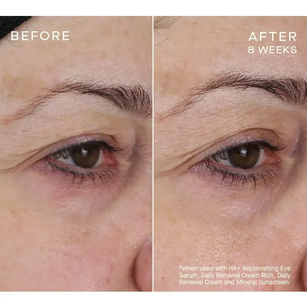 Advanced Regenerative Eye Serum_5.webp