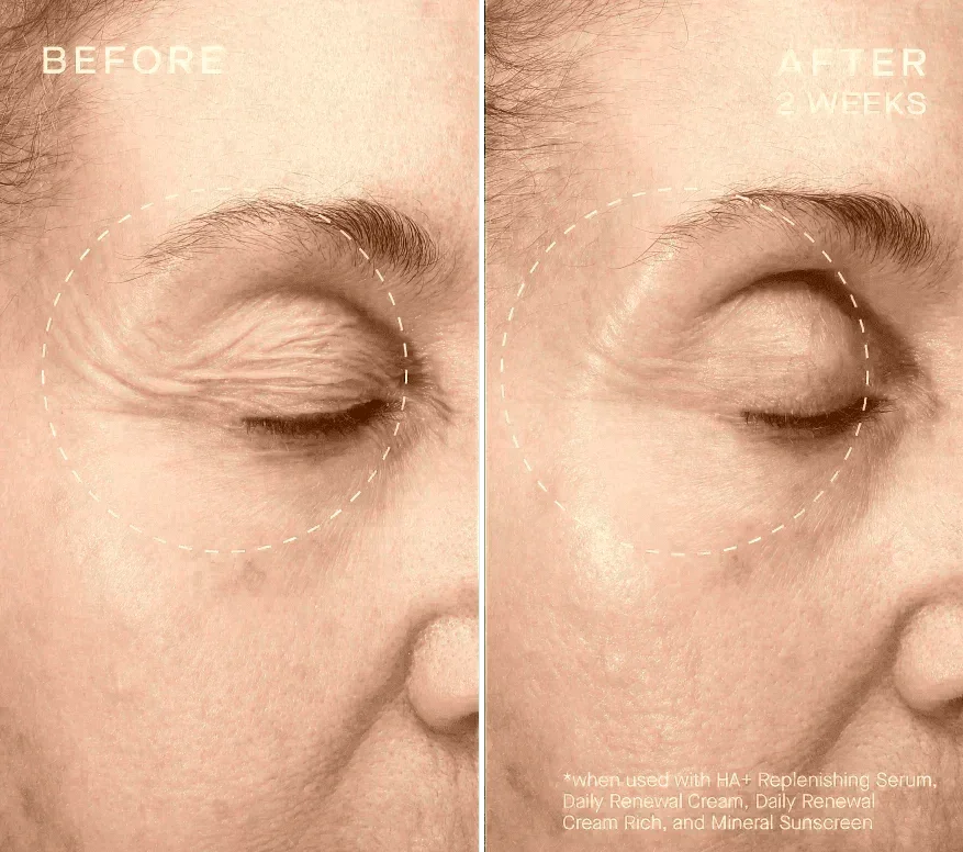 Advanced Regenerative Serum 30mL_2.webp