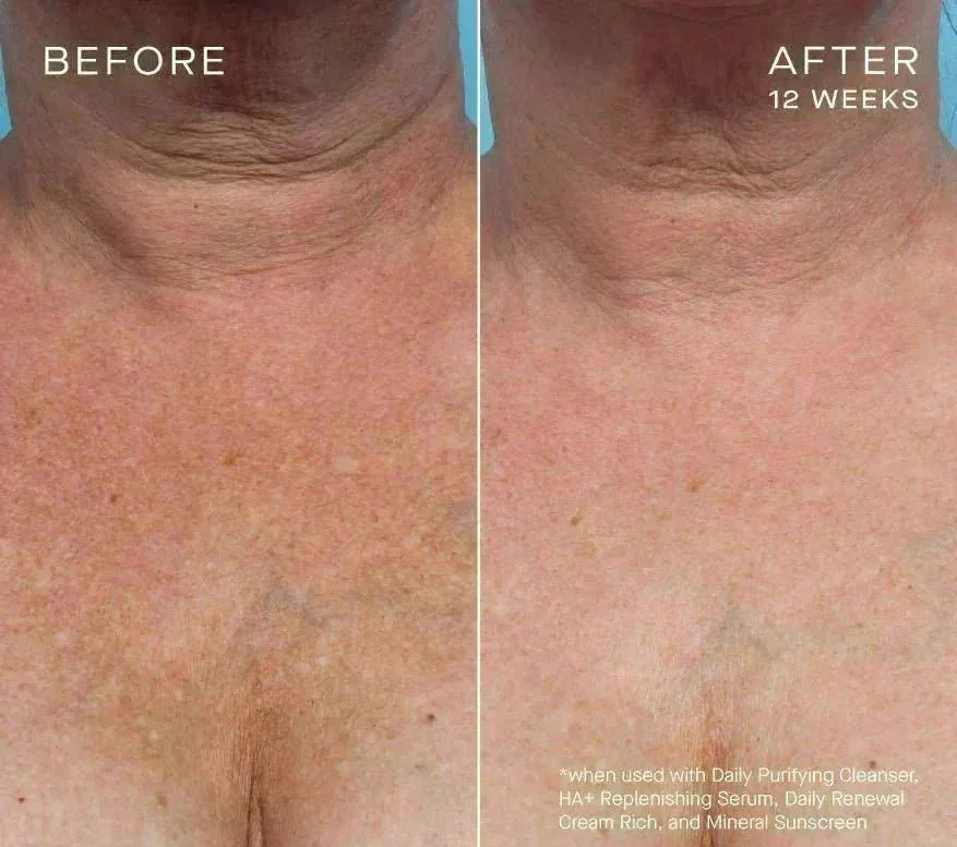 Advanced Regenerative Serum 30mL_6.webp