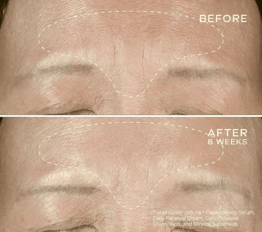 Advanced Regenerative Serum 30mL_4.webp