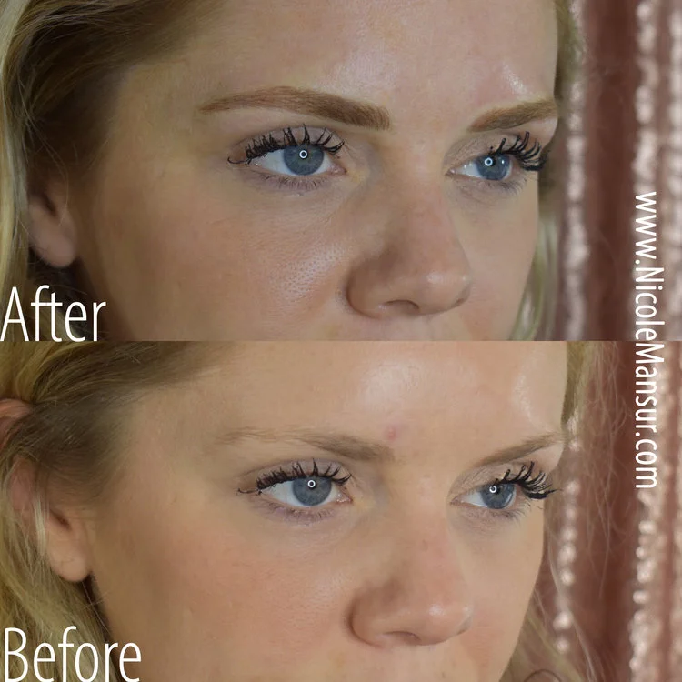 ElizabethRossRightB&A.jpg