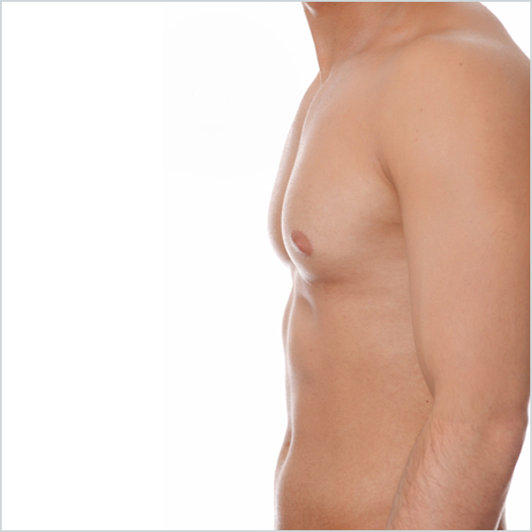 male-breast-reduction.png