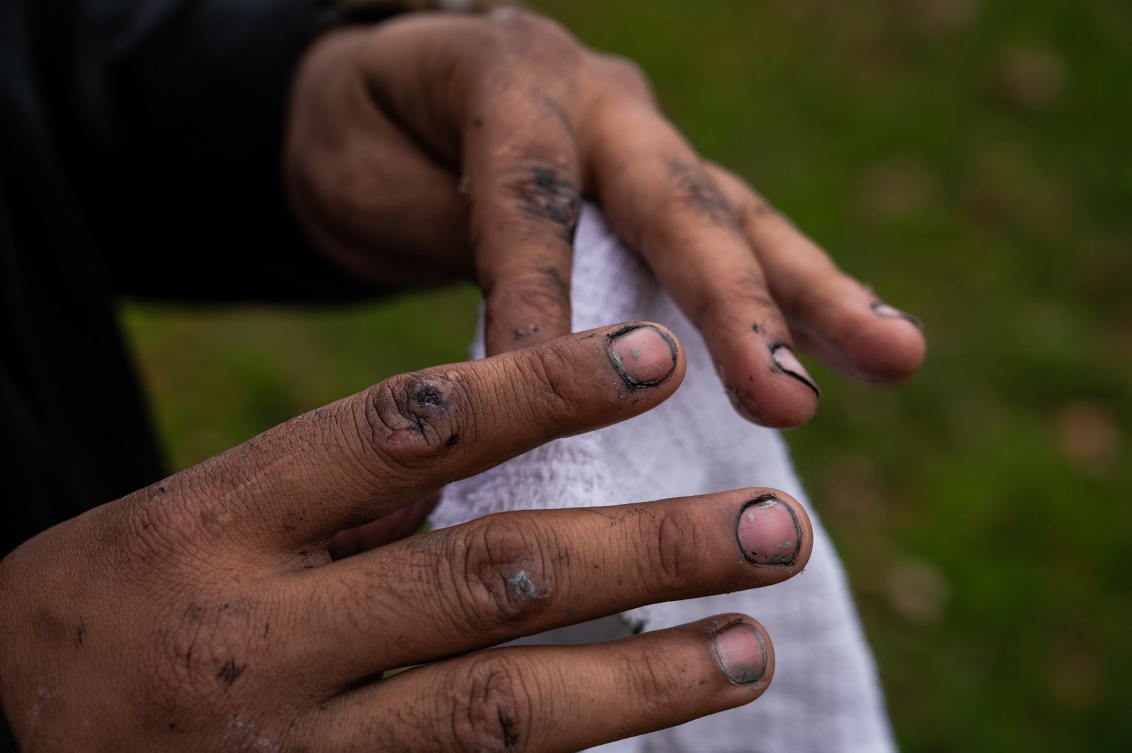  Nolram, who migrated from Venezuela, shows the paint that remains on his hands from his job as a fence painter in Humboldt Park on Oct. 24, 2022. 