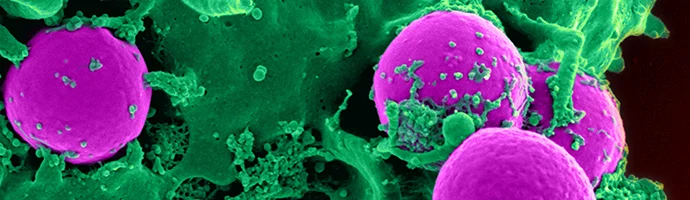 infectious_disease_banner.jpg