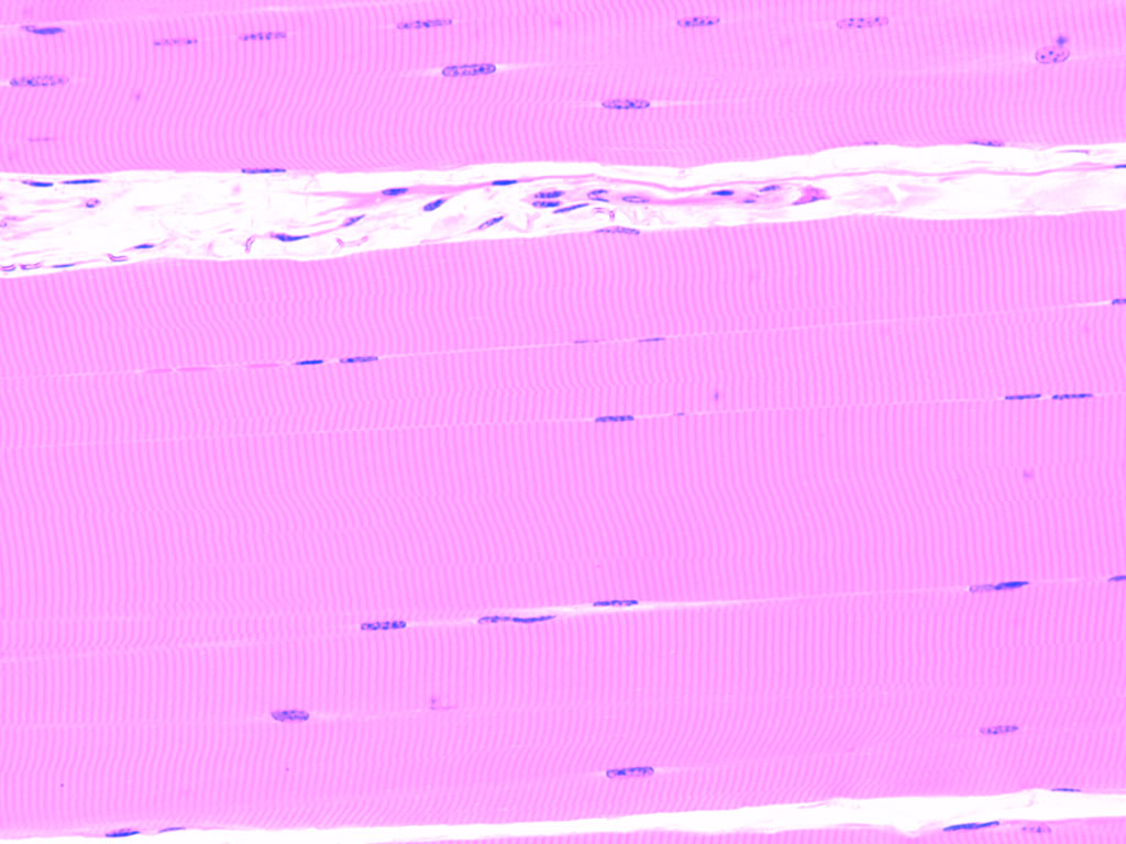 microcurrent - skeletal muscle .jpg
