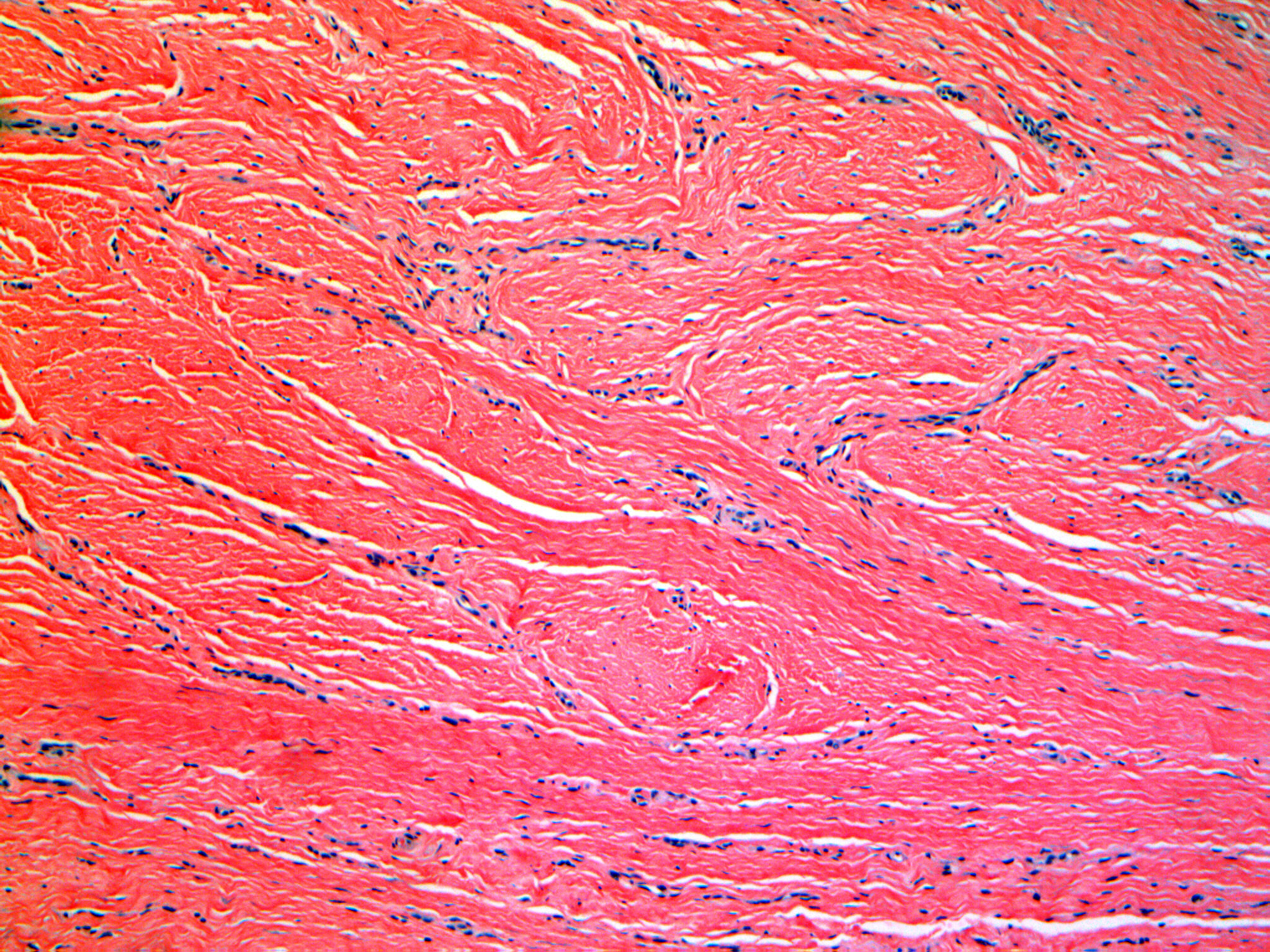 collagen bubbles - microneedling.jpg