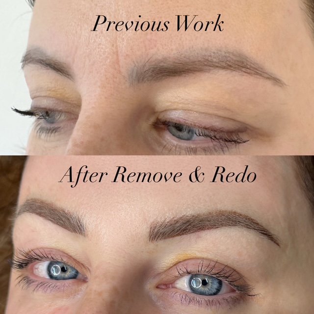 microblading removal, laser tattoo removal, bucks county pa