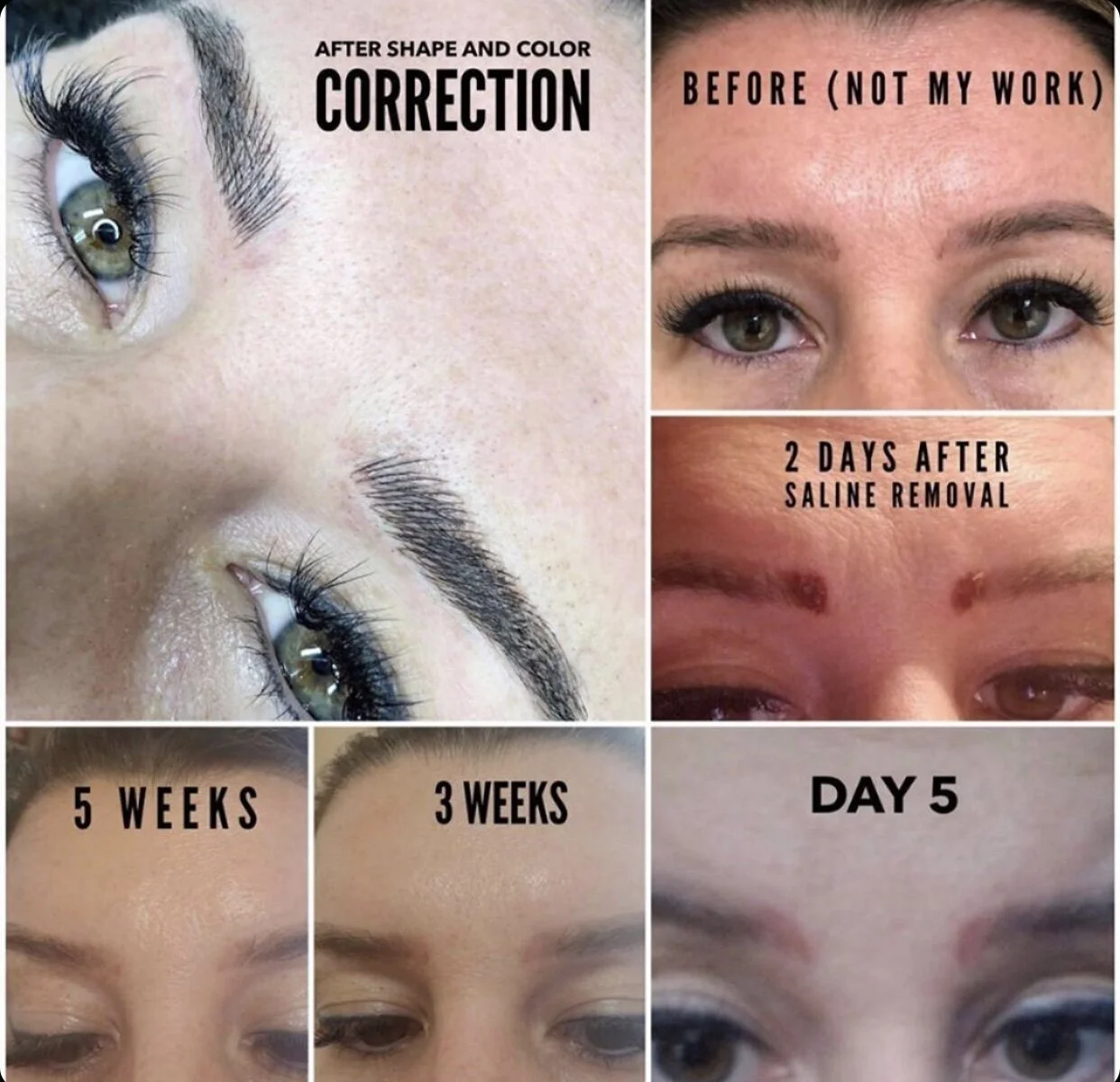 tattoo removal, permanent makeup removal, microblading removal, botched microblading.jpg