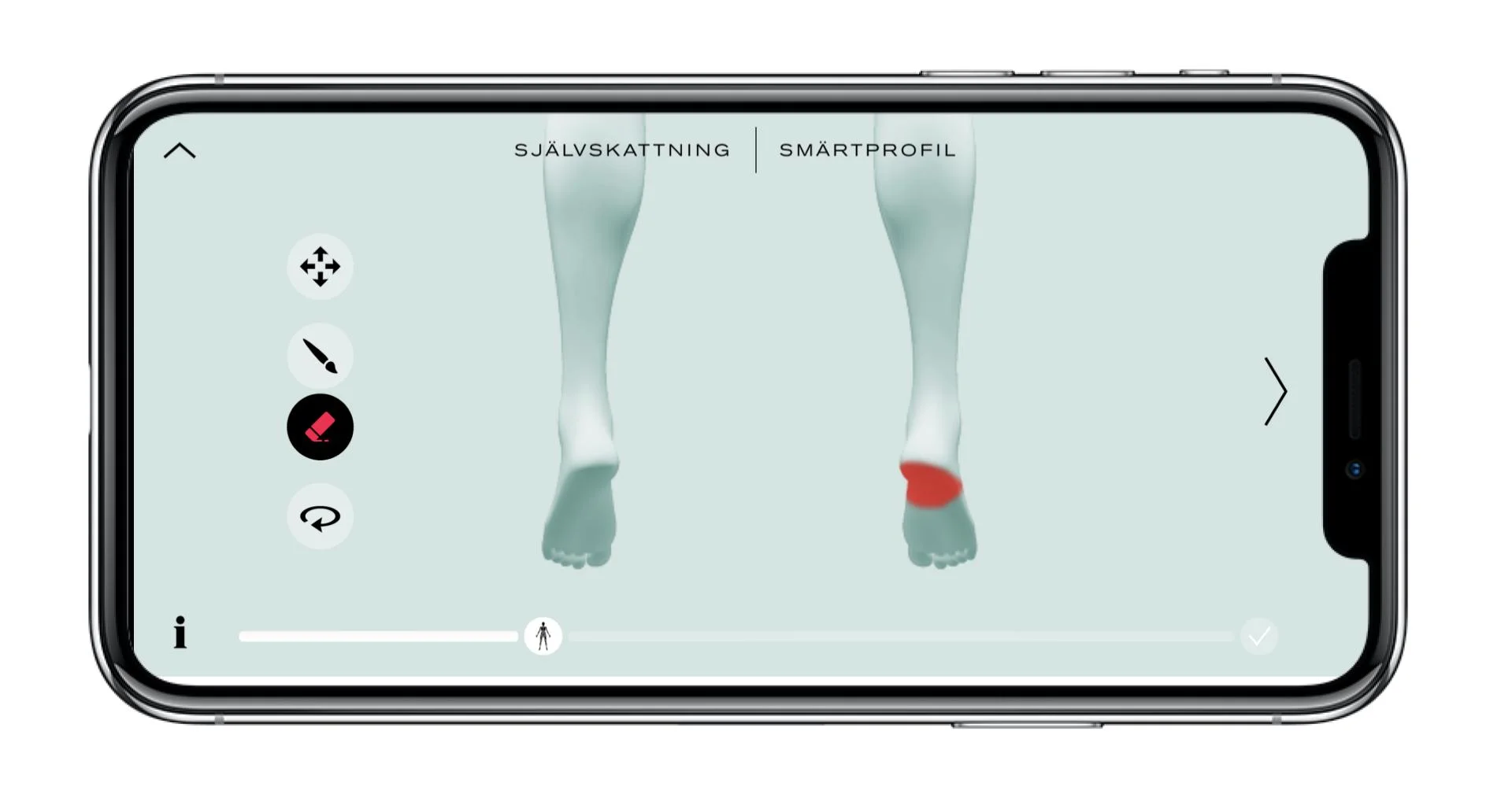 Plantar facilit.jpg
