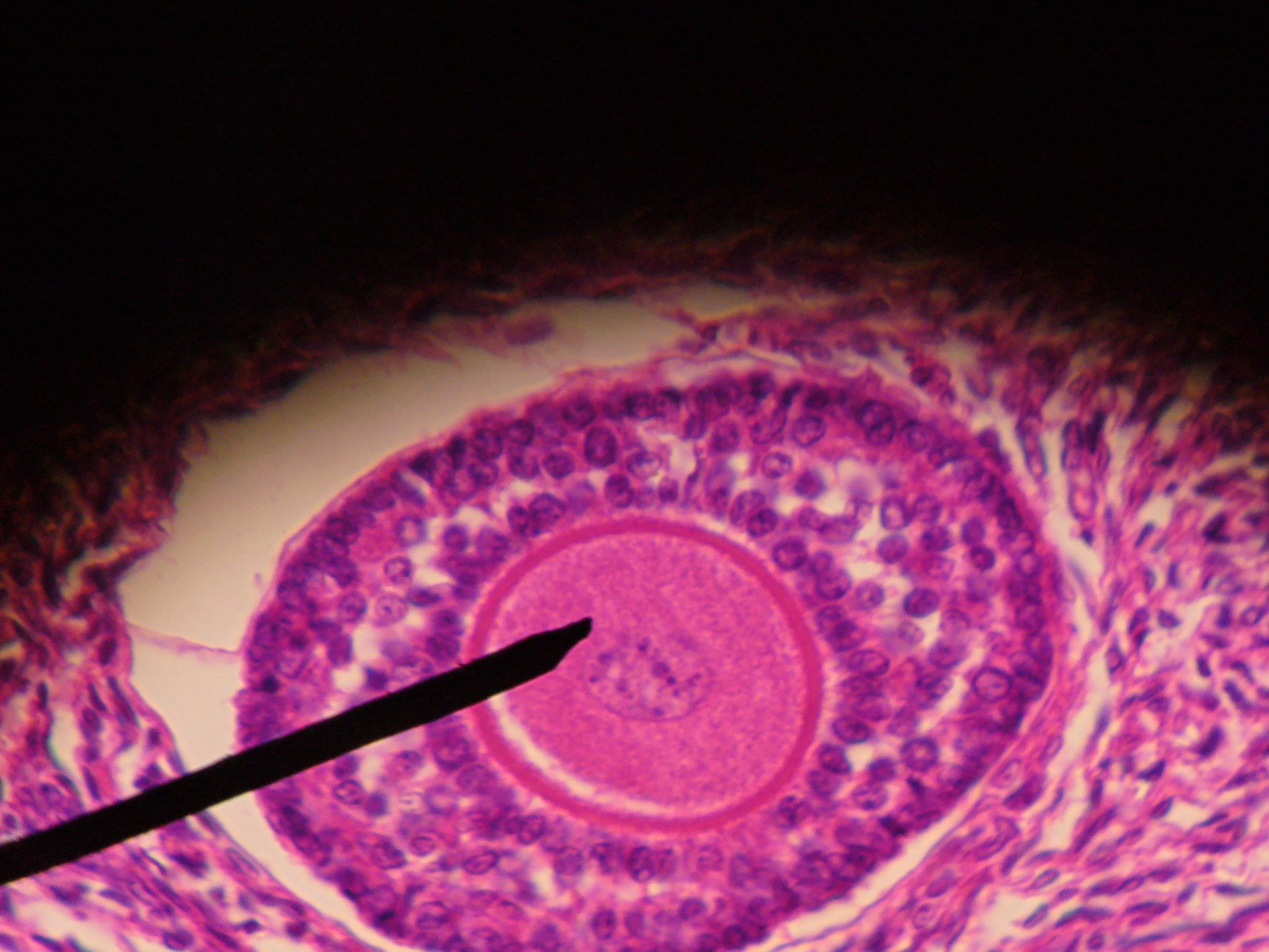 Human_ovarian_follicle.jpg