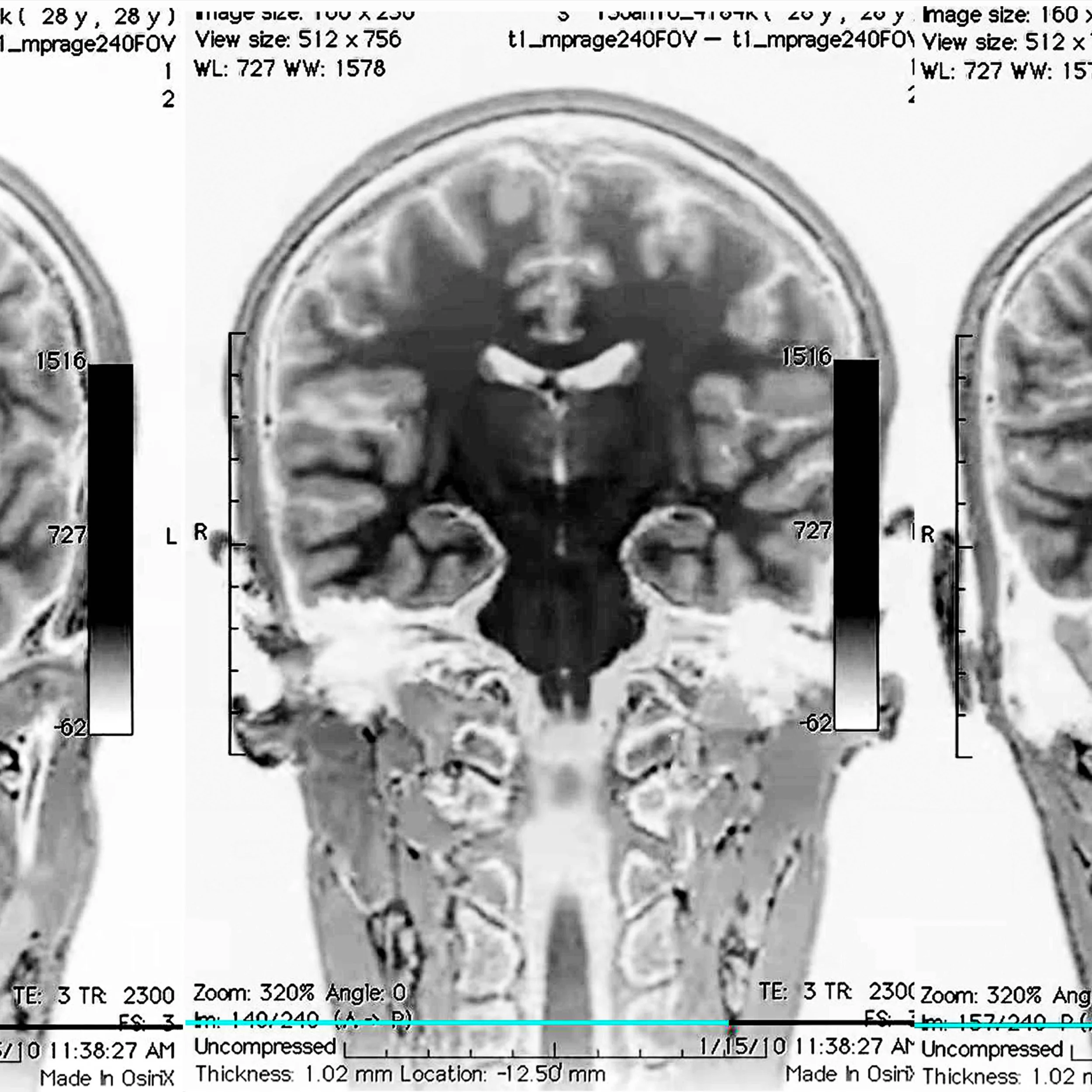 Session 2. June 15-20.