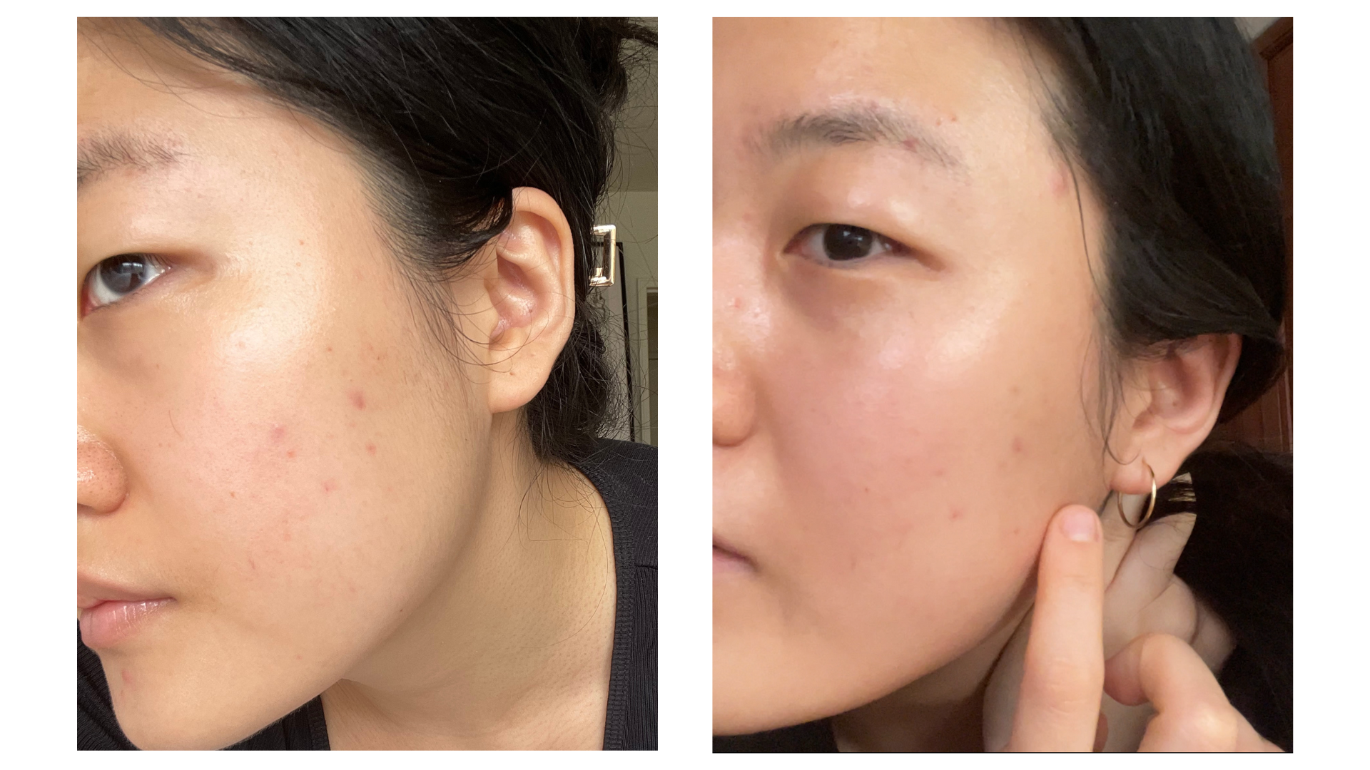 dat is alles Panorama dek This Honey Mask Helped Get Rid Of My Hyperpigmentation — Claire Sua
