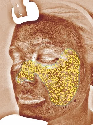 VISIA%2BOverview%2Bscreen%2BCMYK.jpg