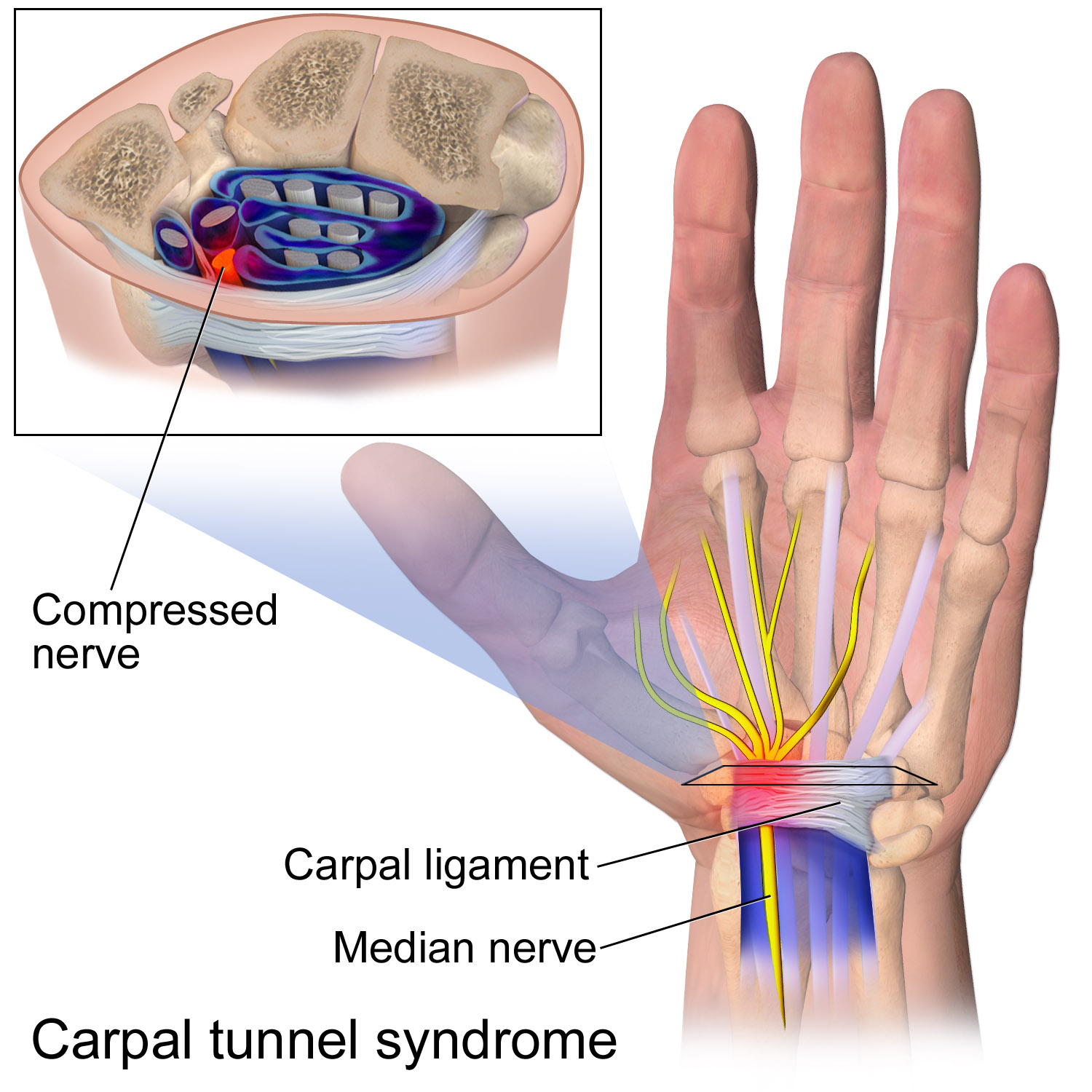 Top of 2024 wrist pain