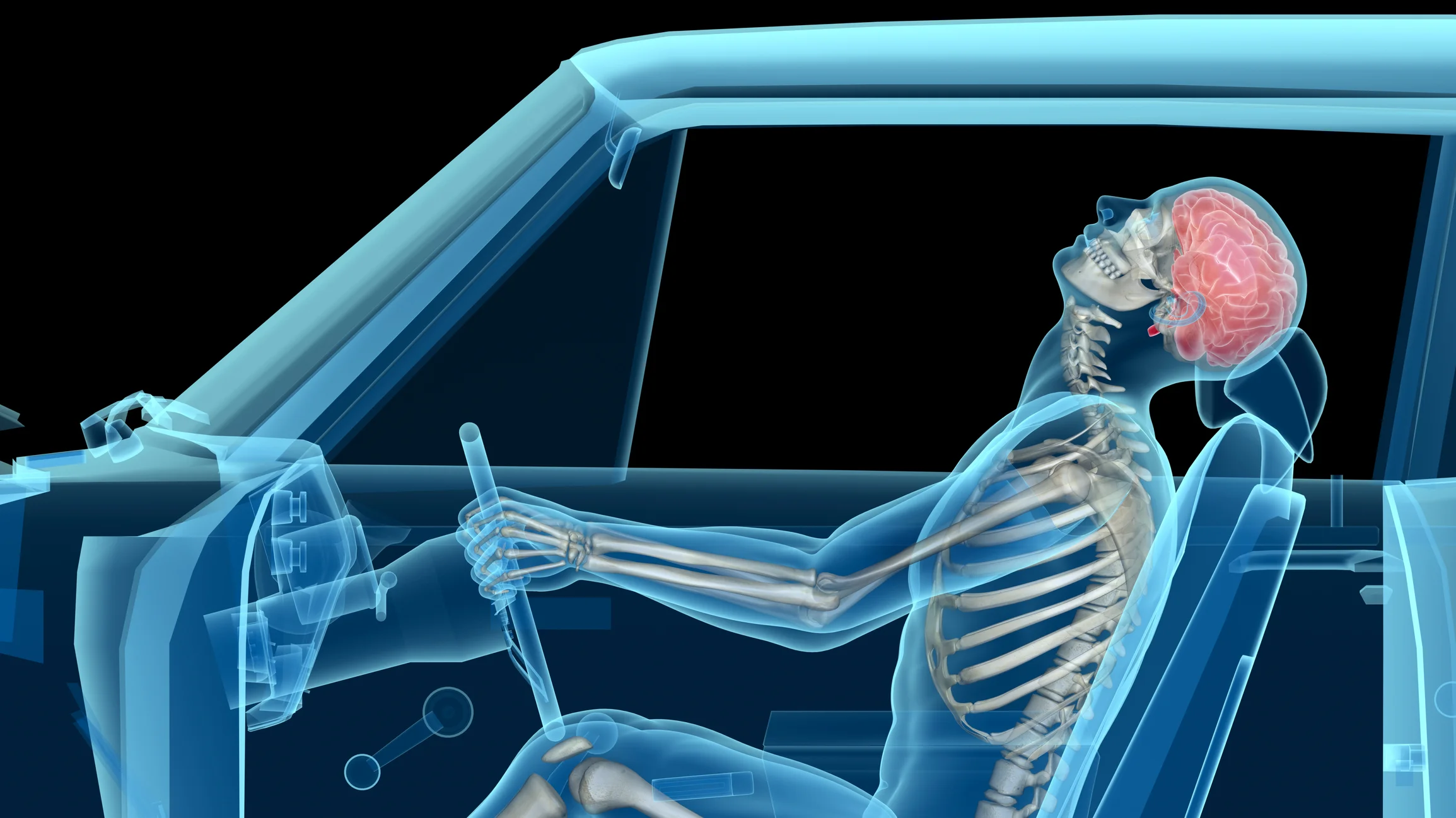 Chiropractic patient in car accident with whiplash