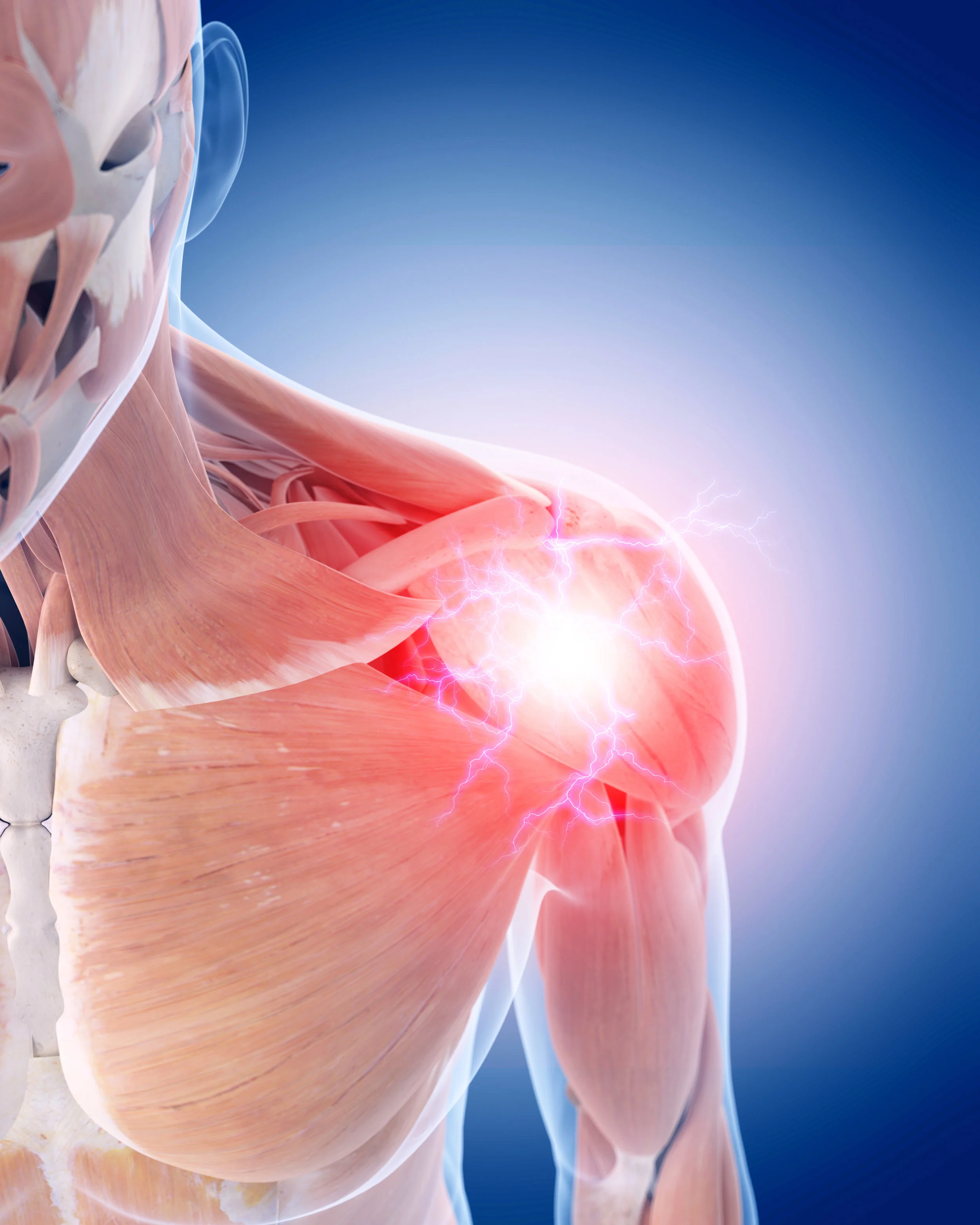 Chiropractic patient with shoulder pain and muscle spasm