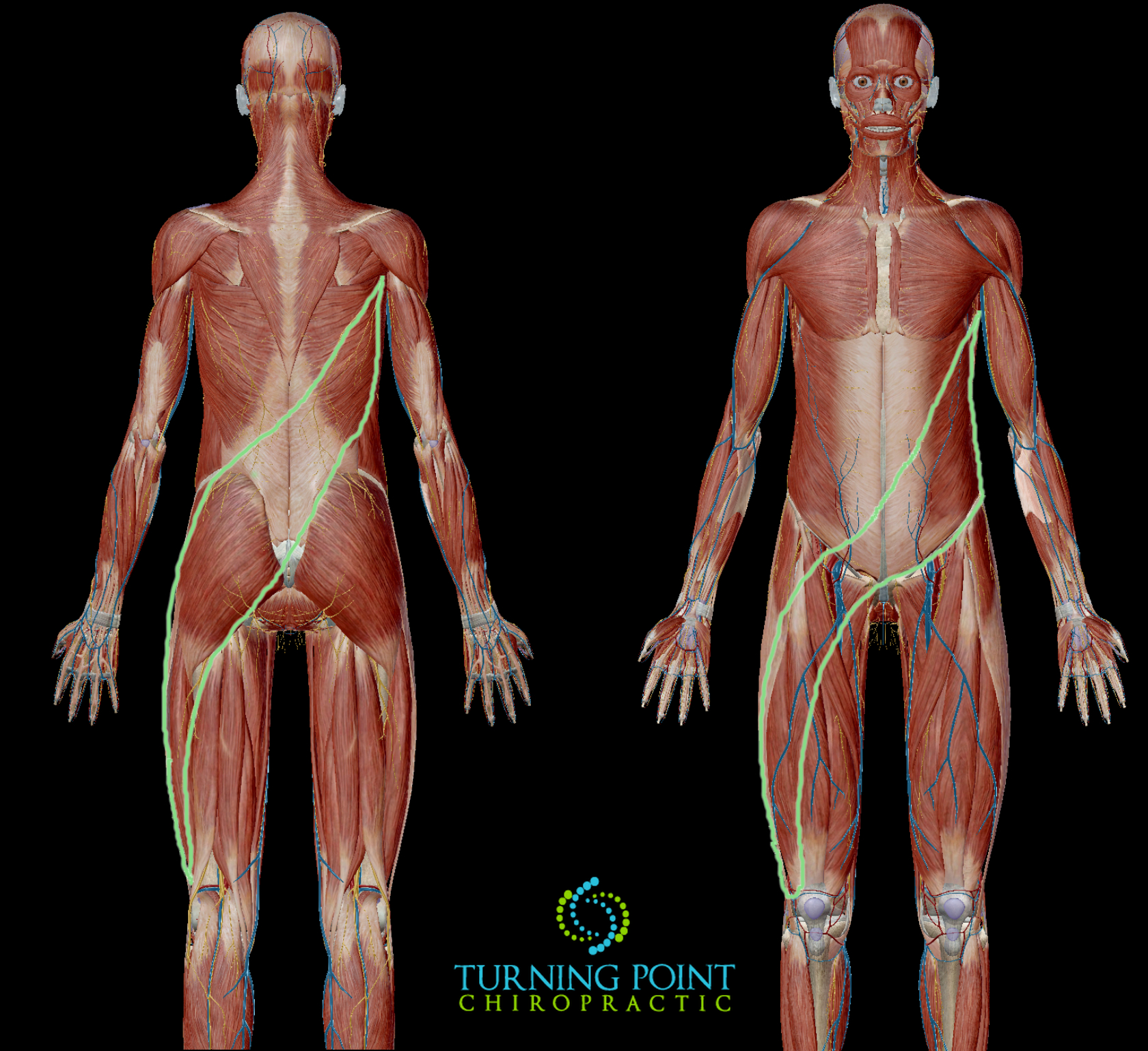 The green outlines posterior and anterior oblique slings. The muscle system that is dominant when doing rotational activity. These can be easily overworked on one side when shoveling.