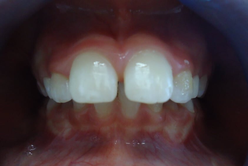 Ortodontia Facealis - Clínica dentária Leiria