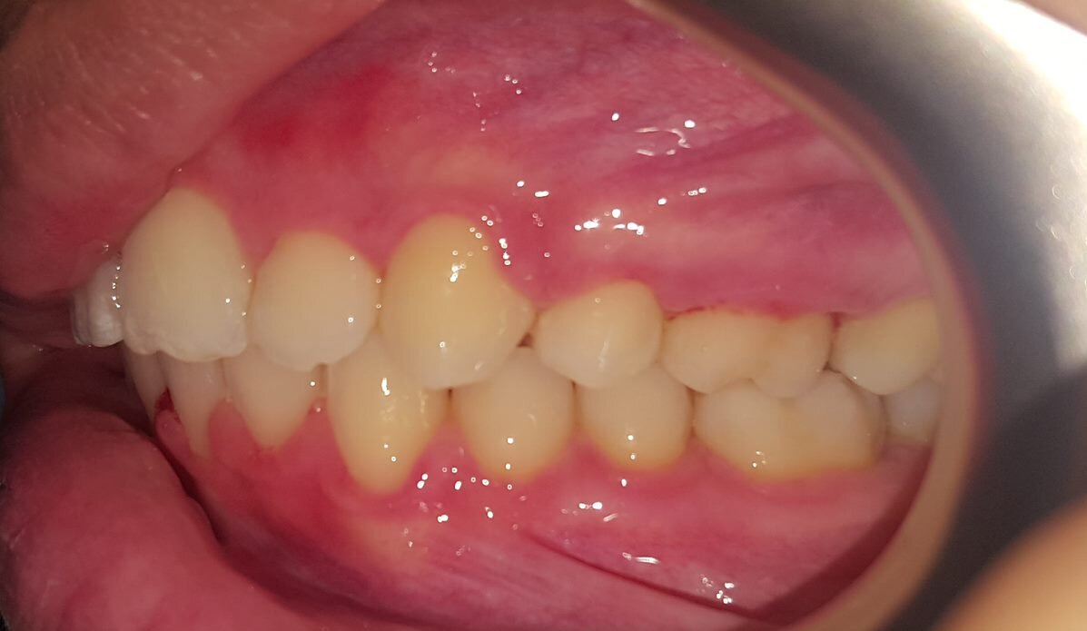 Ortodontia Facealis - Clínica dentária Leiria