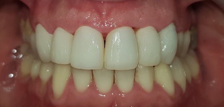 clinica dentária leiria facealis