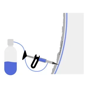 STEP 2 Apply Treatment(s)  
We will execute the plan by applying treatment to each tree indicated on the plan. This may require multiple visits throughout the year to ensure the best possible outcome for your tree.