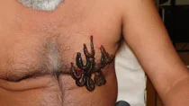 Leeches shown during treatment of varied conditions