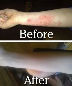 beforeandafter.jpg