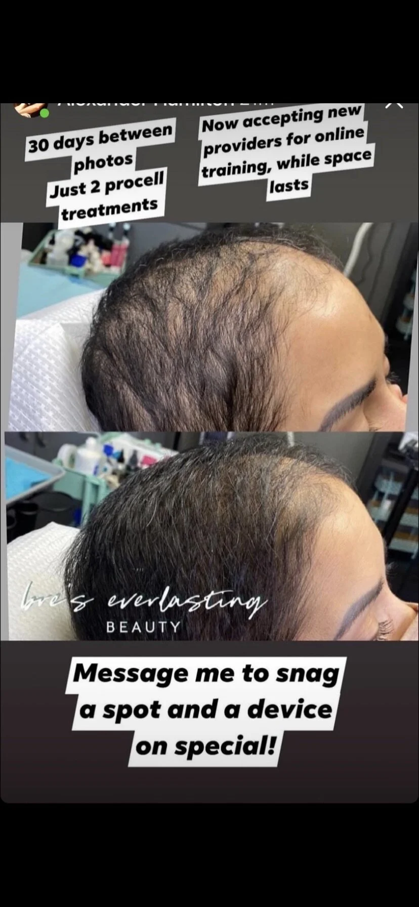 5DD63C64-9841-455A-9EFC-A24E705BF2C8