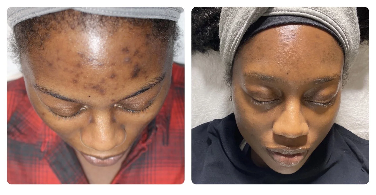 65877AFE-2D44-442C-8654-0FA061B0AE8B