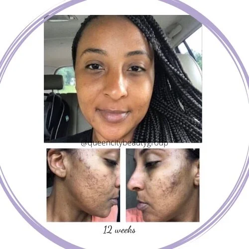 4C14357C-38DD-41CD-A629-3FABB93DB5C2